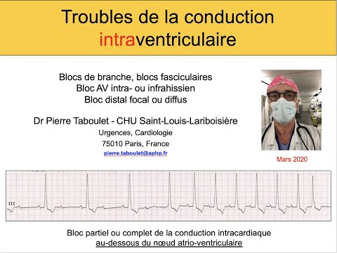 4b. Les blocs intraventriculaires. Bloc de branche, BAV. Dr Taboulet