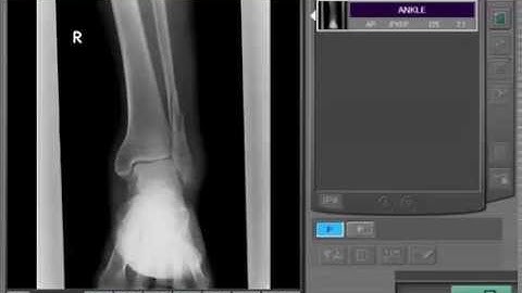 Fujifilm FCR QA (Fujifilm Malaysia)