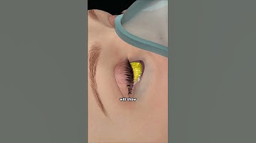 Blepharoplasty!!! #drone #theflash #space #automobile #scifi #doctor #3danimation #anatomy #facts