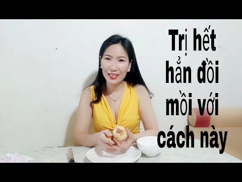 Video Mẹo trị hết hẳn đồi mồi chỉ với củ hành tây mà ít ai... - youtube