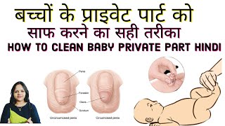 बच्चों के प्राइवेट पार्ट को साफ करने का सही तरीका। How to Open Private Part of Baby Boy – Baby Mommy