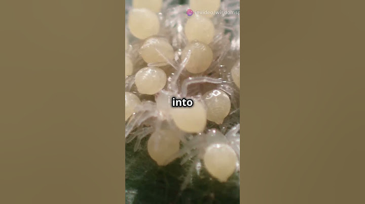 Why You Shouldn’t Stomp on a Spider 🕷️