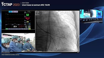 [TCTAP 2023] Live Case & Lecture #2: TAVR