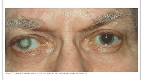 Elements of Visual Perception