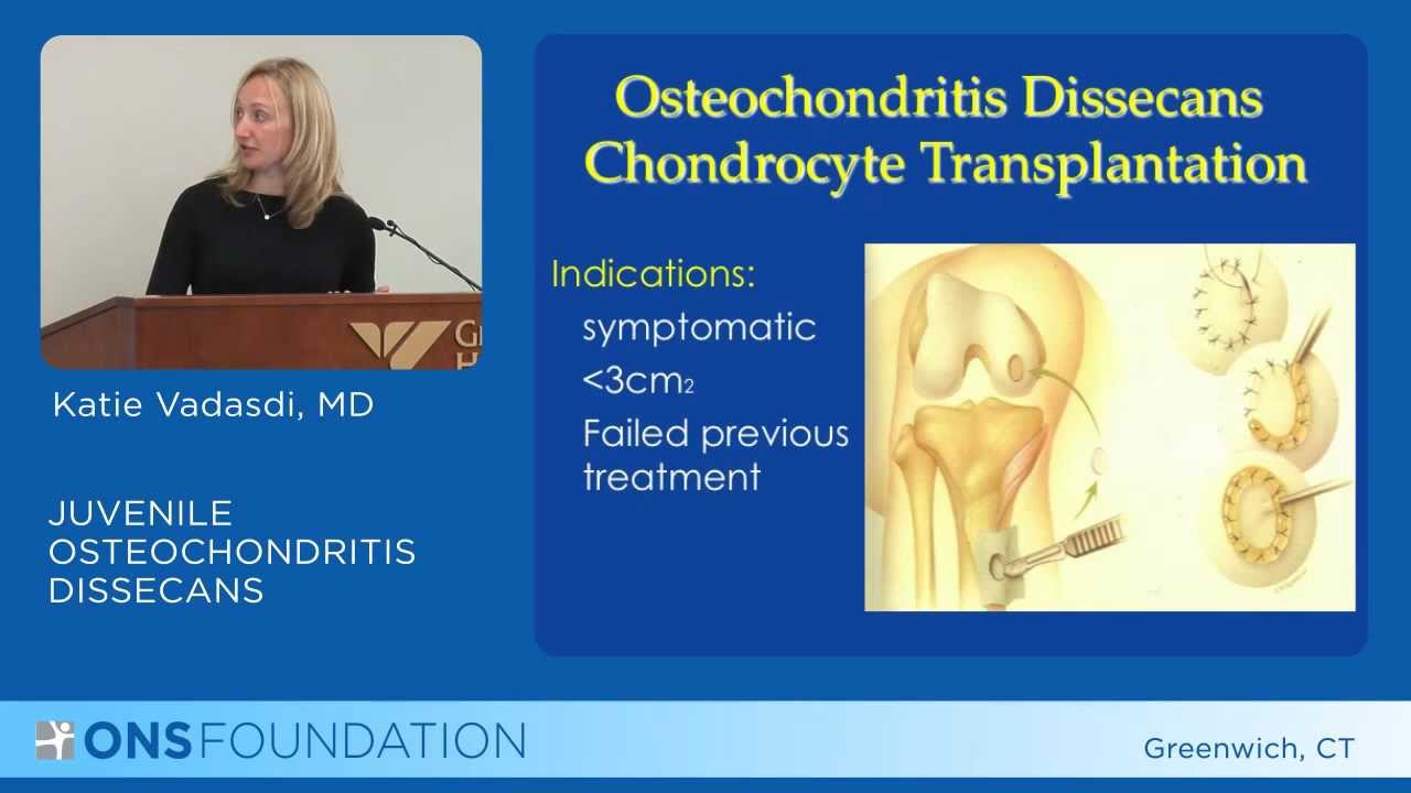 osteochondrosis artrosis kezelése