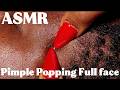 ASMR |HUBBY'S FACE PIMPLE POPPING WITH WHISPERS #pimplepopping #asmr #nitpicking #viral #pimple