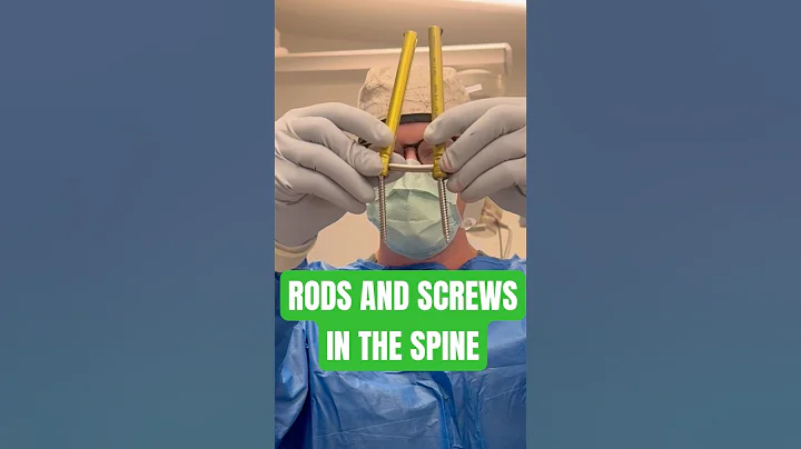 How Rods & Screws work in Spine Surgery