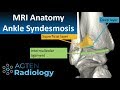 MRI Anatomy of ankle ligaments: Syndesmosis