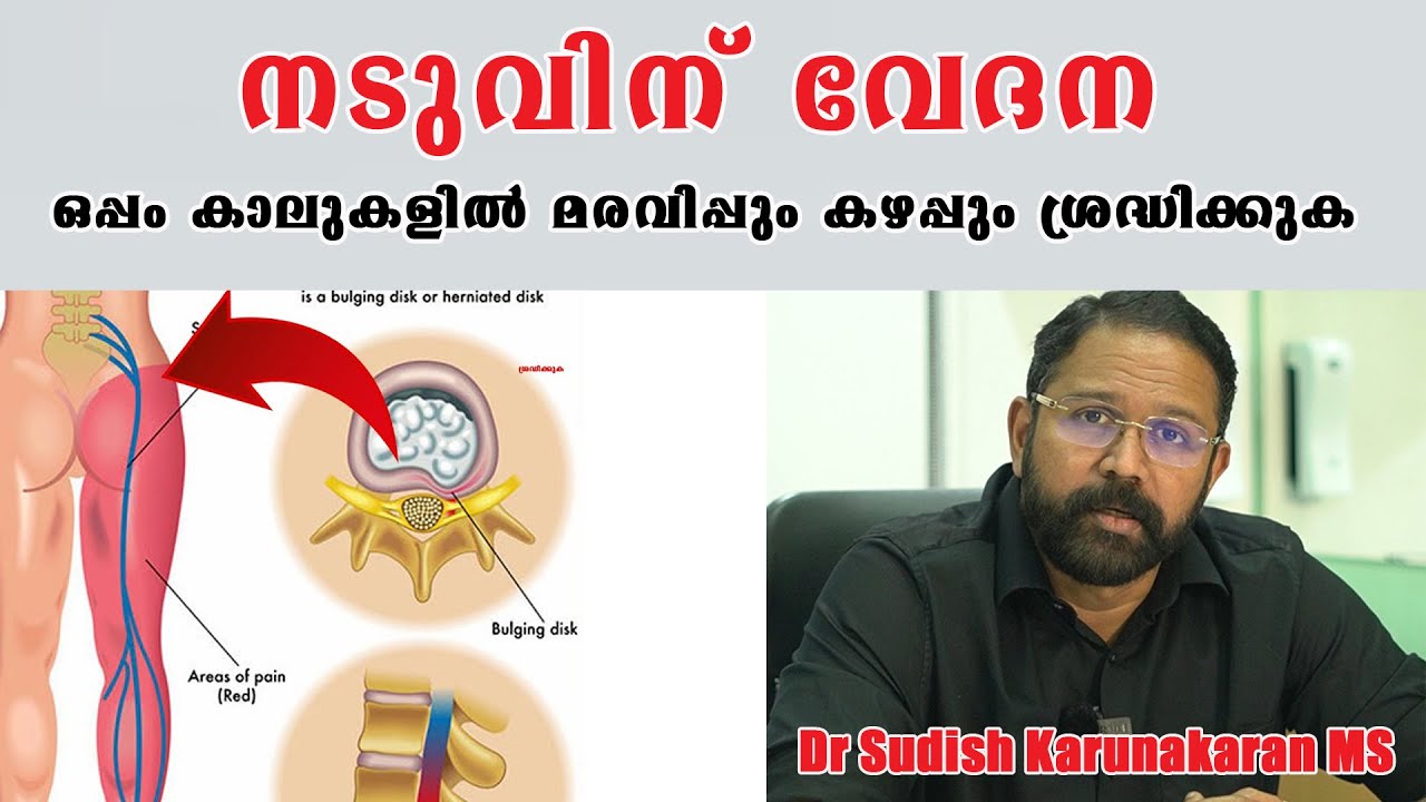 നടുവിന് വേദന ഒപ്പം കാലുകളിൽ മരവിപ്പും  കഴപ്പും ശ്രദ്ധിക്കുക /Back Pain /Baiju's Vlogs