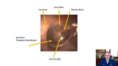 WiscMed Normal Ear Anatomy as Seen by an Otoscope