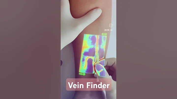 Easy Pain pain-free IV insertion