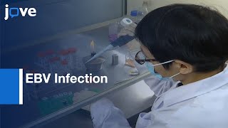 EBV Infection used for NK and T Cell lines Establishment | Protocol Preview