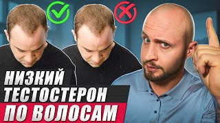 Связно ли облысение с НИЗКИМ уровнем тестостерона? / Что нам может сказать состояние наших волос?