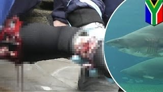 Беременная акула чуть не отгрызла руку ныряльщику
