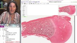 Popular Classic (F13)- Endochondral ossification