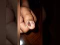 YOUTUBE LIVE TODAY 9PM ((अपनी त्वचा और बालों से संबंधित प्रश्न पूछें) #shortsfeed #shorts #ytshorts