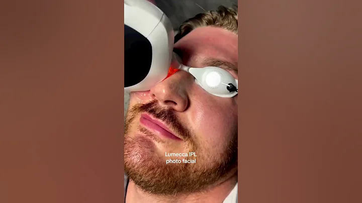 Lumecca - IPL season is here #beauty #skincare #shorts