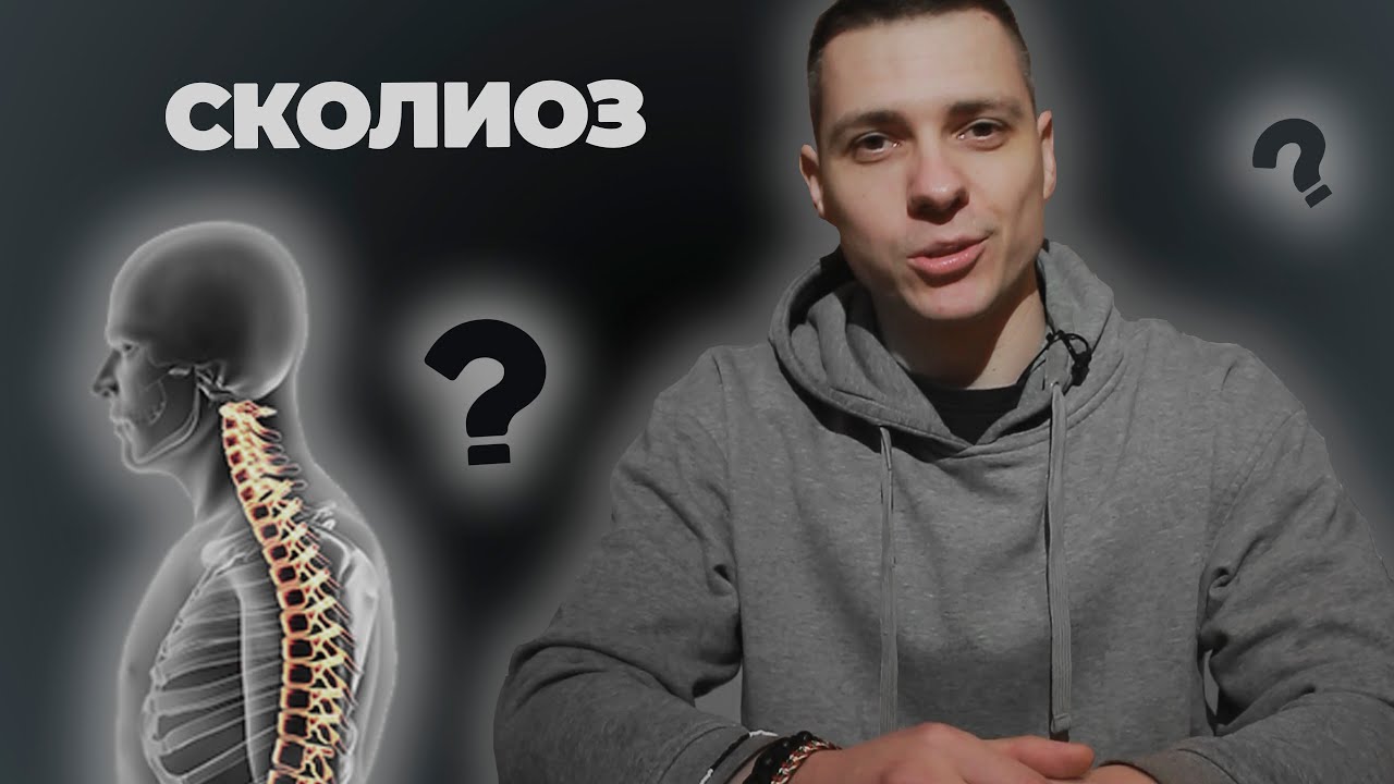 🎙️Сколиоз: причины, симптомы и лечение. Хронические боли в спине - YouTube