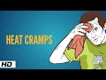 Heat cramps, Causes, Signs and Symptoms, Diagnosis and Treatment.