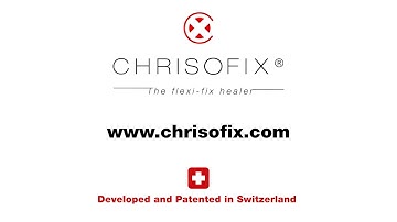 CHRISOFIX® - Introduction video