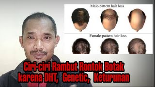 Ciri2 Rambut Botak Genetik, hormon DHT