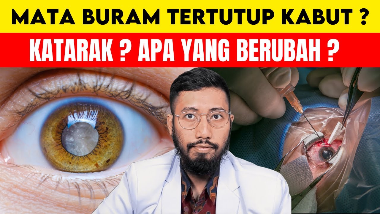 Katarak Mata: Penyebab, Gejala Buram Penglihatan & Pengobatan Operasi yang Efektif