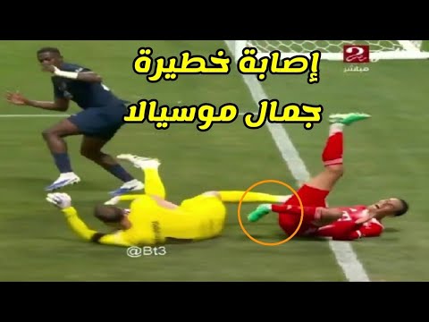 إصابة جمال موسيالا في مباراة بايرن ميونيخ و سان جيرمان اليوم