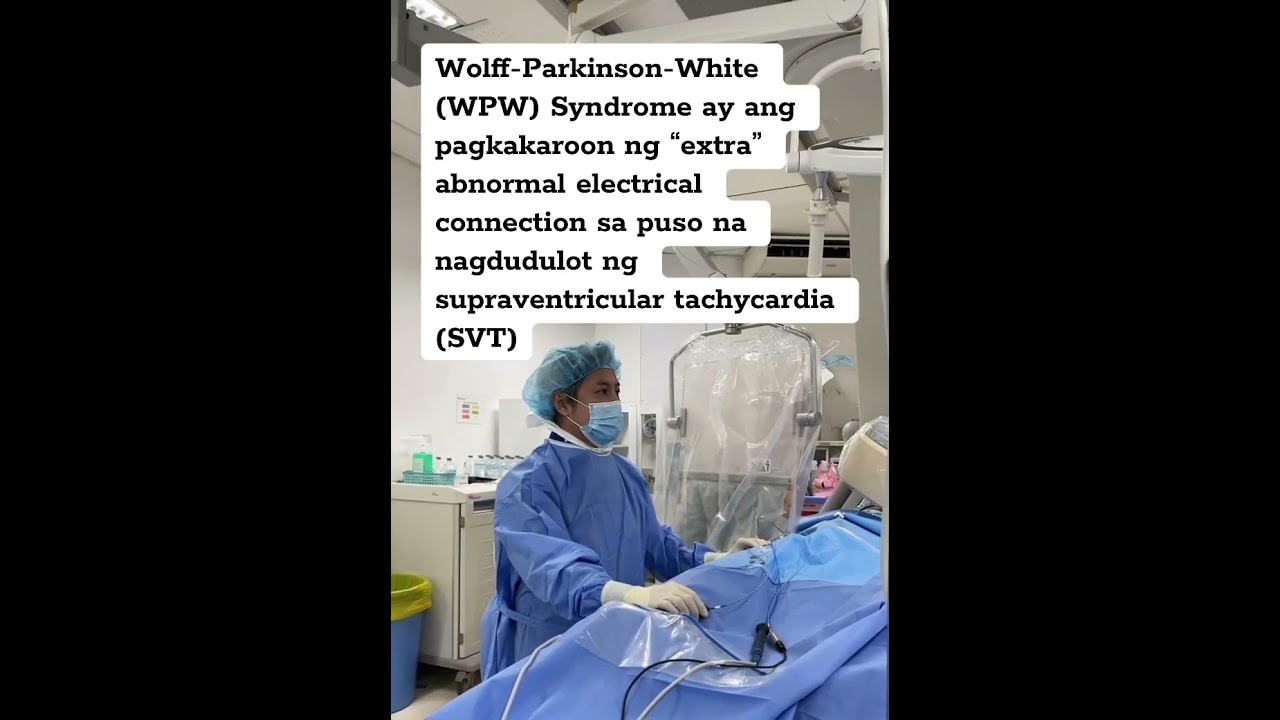 Radiofrequency ablation for WPW Syndrome 