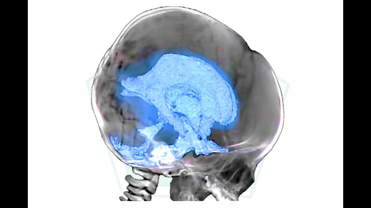 health industry cybersecurity practices Hidrocefalia