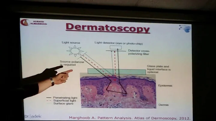 Dr Ahmed Sadek - Introduction to dermoscopy - Part 1