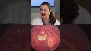 Cirurgia de Amígdalas: Pós-Operatório Revolucionário Sem Dor! #shorts
