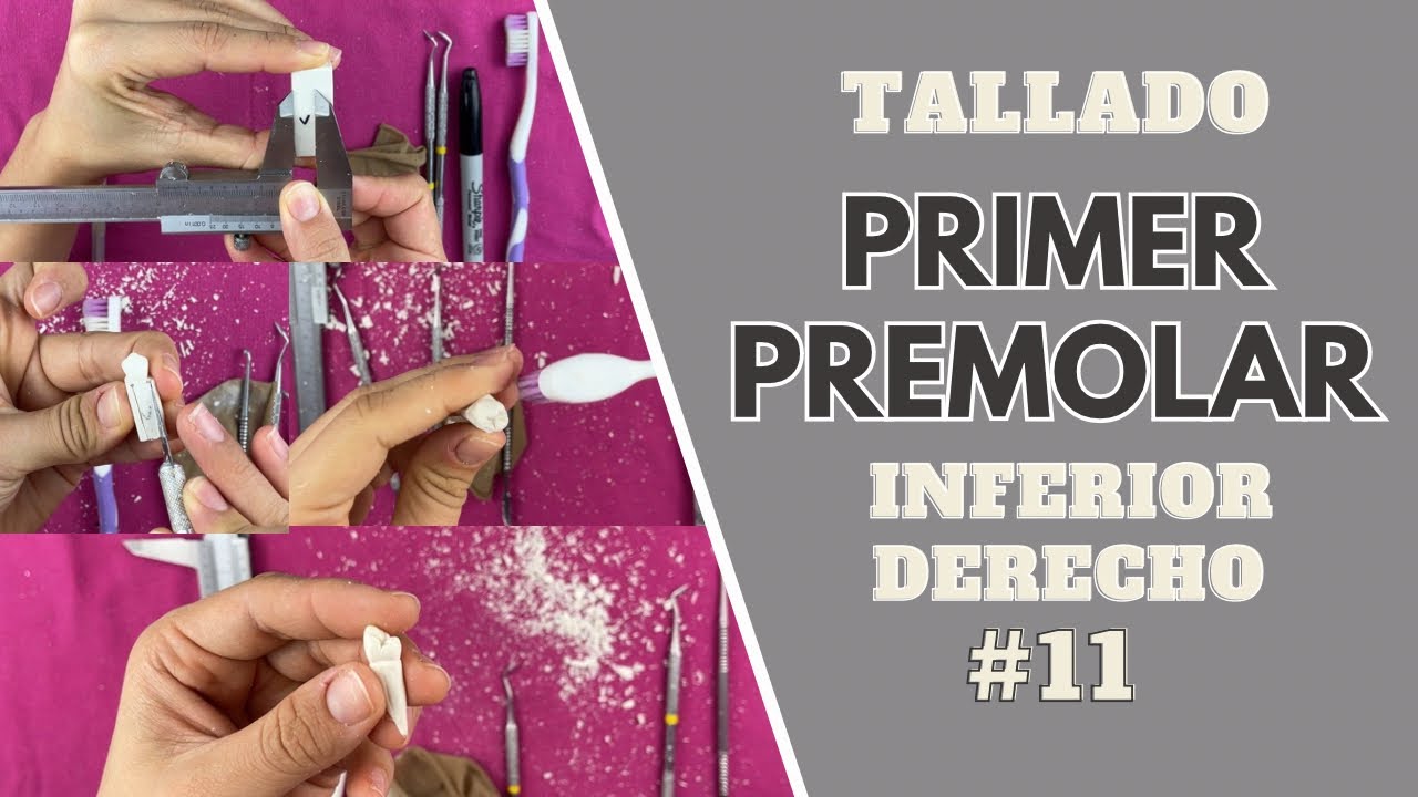 Tallado en cera de primer premolar inferior derecho | Odontologia Con Cri