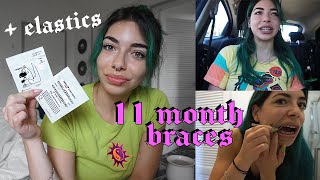 11 month braces update // wearing elastics for the first time + green braces to match my hair ;)