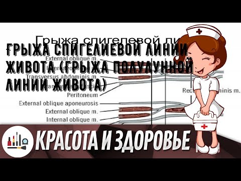 Видео: Являются ли спигелиевые грыжи болезненными?