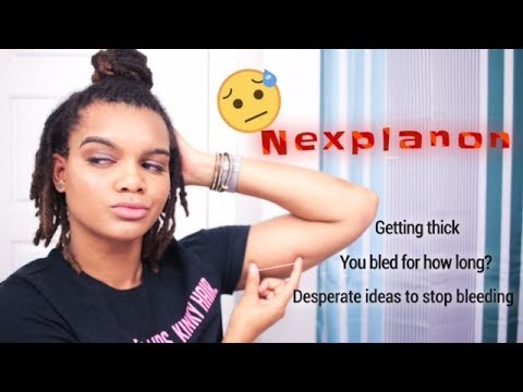 my-love-/-hate-relationship-with-nexplanon-2017-|-bled-for-how-long?-|-one-year-update