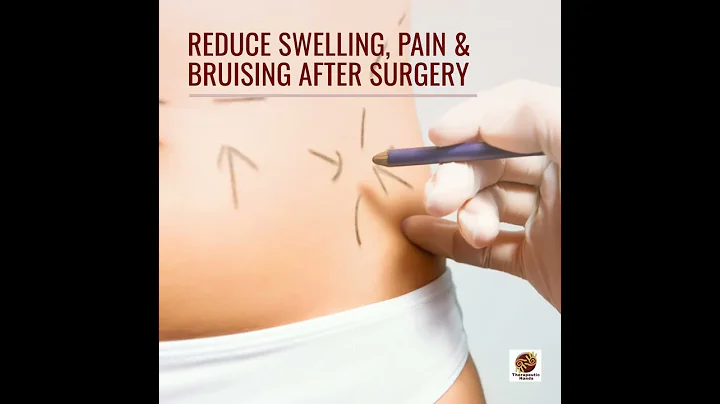 Lymphatic Drainage Massage After Liposuction