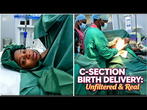 Official C-Section Birth Vlog | [Unfiltered & real]