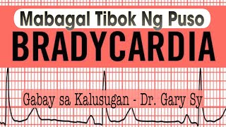Bradycardia (Slow Heart Rate) - Dr. Gary Sy by Gabay sa Kalusugan - Dr. Gary Sy 15,690 views 3 months ago 14 minutes, 56 seconds