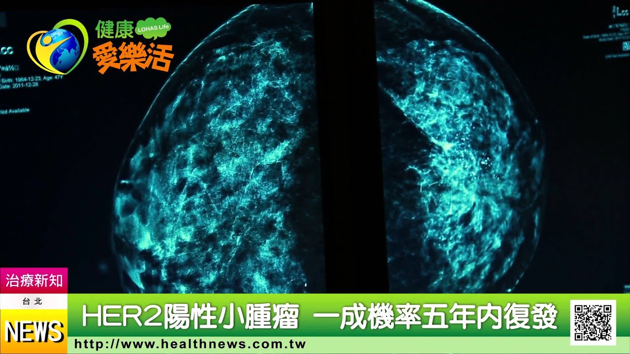 乳癌治癒六年再復發　50歲婦生不如死