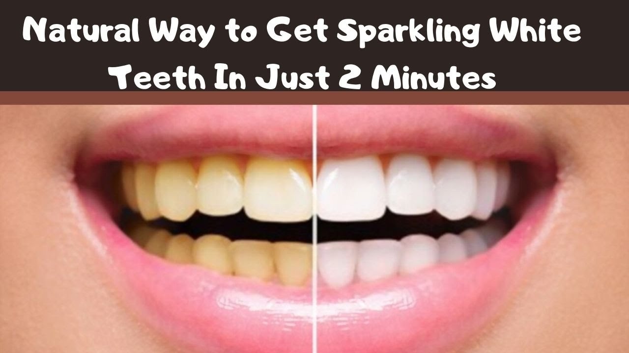Teeth Whitening At Home In 2 Minutes Magical Teeth Whitening Remedy YouTube