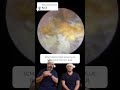 Replying to @Ear Wax Removal Audiology Ass’ 3CM/1.2INCH EAR WAX PLUG REMOVED FROM 1 EAR