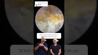 Replying to @Ear Wax Removal Audiology Ass’ 3CM/1.2INCH EAR WAX PLUG REMOVED FROM 1 EAR