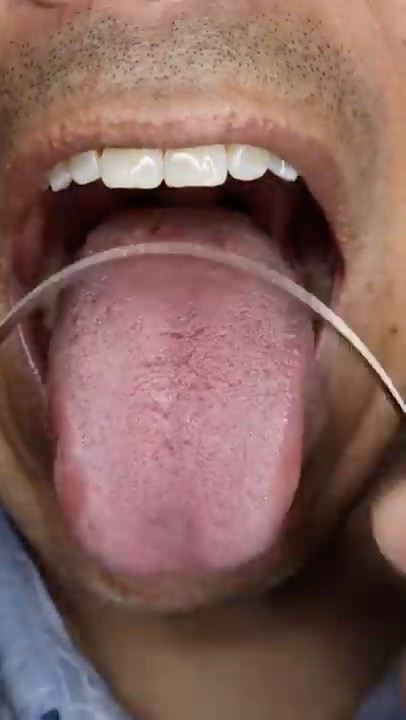 Tongue π
Scrapping ASMR π #shorts #asmr