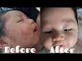 RAISING A FIL-KOR BABY VLOG | HOW WE GOT RID OF OUR BABY’S HEAT RASHES