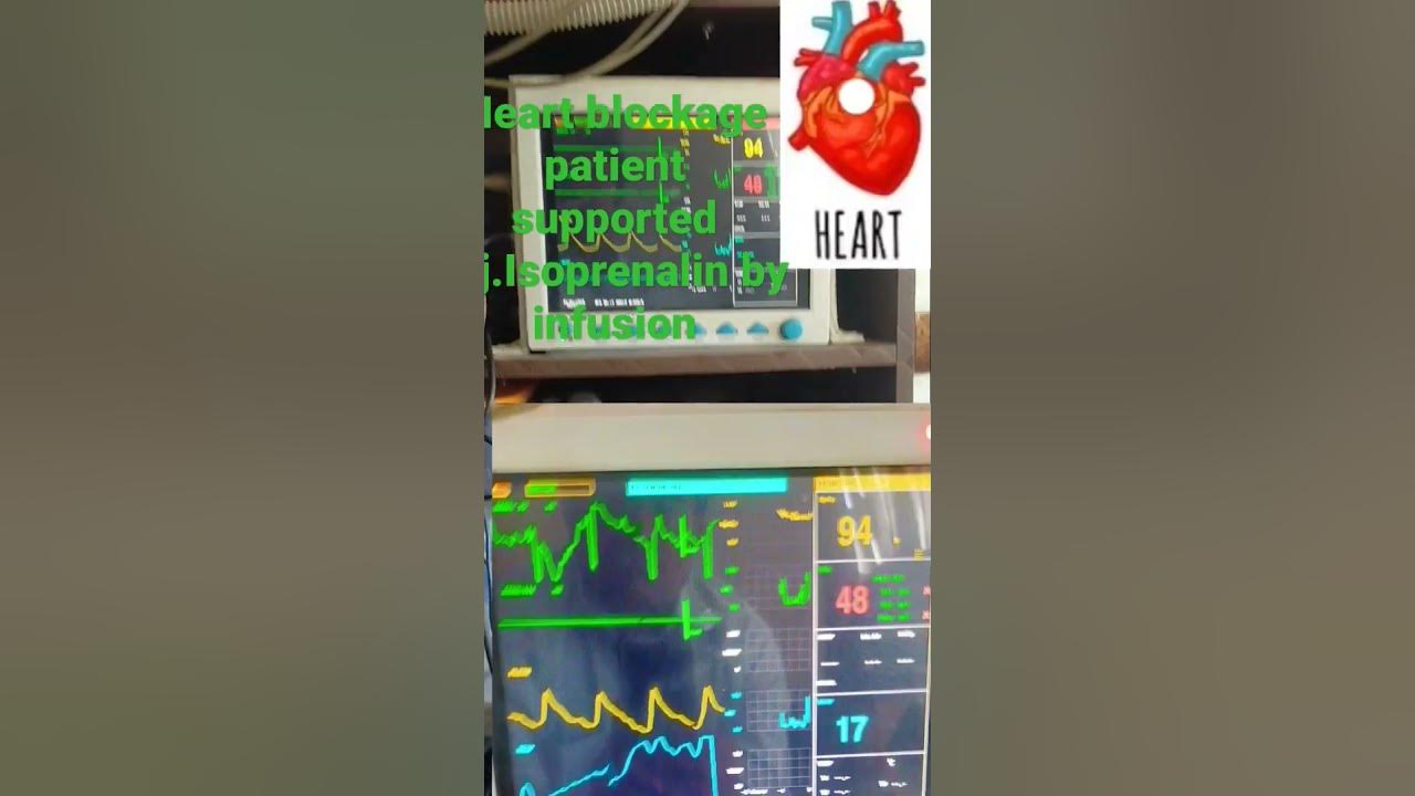 heart-blockage-patient-supported-inj-isoprenaline-short-youtube
