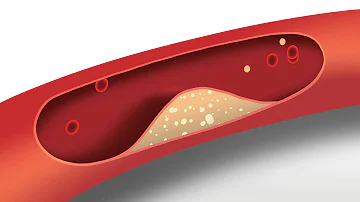 Blood Pressure Animation | Heart disease risk factors