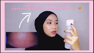 Review Pond's Serum Burst Cream (Serum Bagus Untuk Remaja😍) || Verent Rusli