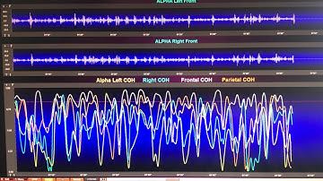Relaxation period EEG of Subject A