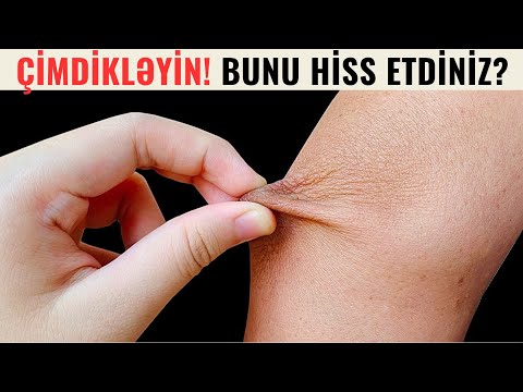 Video: Hiss qabiliyyəti əlillikdirmi?