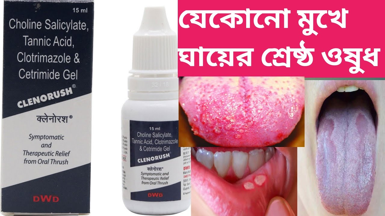 Clenorush Gel Uses In Bengali Clenora Gel মুখের ঘায়ের ওষুধ YouTube